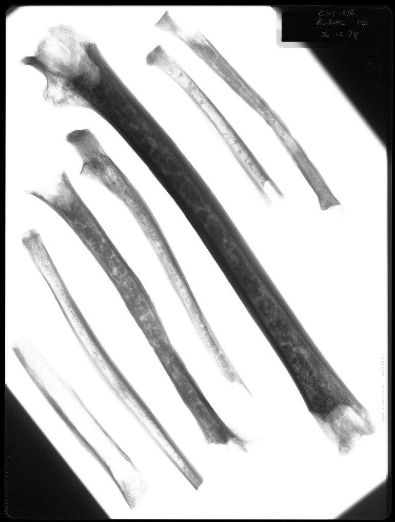 Seven human bones - potentially from the leg and arms.